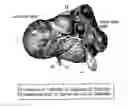 Fig. 01 - METHOD FOR PRODUCING DETOXIFIED LIVER