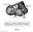 Fig. 07 - METHOD FOR PRODUCING DETOXIFIED LIVER