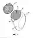 Fig. 02 - FOAMING POROUS PAD FOR USE WITH A MOTORIZED DEVICE