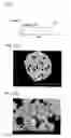 Fig. 02 - CERMET POWDER