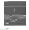 Fig. 07 - Nanofiber ribbons and sheets and fabrication and application thereof