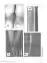 Fig. 70 - Nanofiber ribbons and sheets and fabrication and application thereof