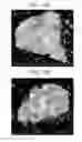 Fig. 09 - Anode active material and a lithium secondary battery including the same