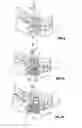 Fig. 05 - Surgical guide system for dental implantology and method for making the same