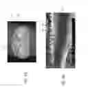 Fig. 17 - Apparatus and methods for filling teeth and root canals