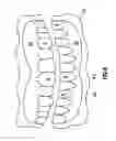Fig. 06 - ONE VISIT DENTURE