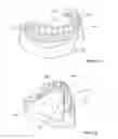 Fig. 02 - DENTAL BRIDGE ATTACHMENT SYSTEM AND METHOD