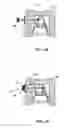 Fig. 09 - DENTAL BRIDGE ATTACHMENT SYSTEM AND METHOD
