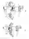 Fig. 04 - Method for articulator adjustment and gnathological instruments for work under this method