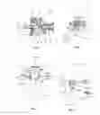 Fig. 05 - Method for articulator adjustment and gnathological instruments for work under this method