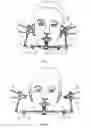 Fig. 06 - Method for articulator adjustment and gnathological instruments for work under this method