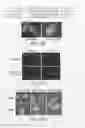 Fig. 19 - DOT1 histone methyltransferases as a target for identifying therapeutic agents for leukemia