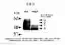 Fig. 04 - METHOD FOR DETECTING CANCER, AND ANTIBODY CAPABLE OF RECOGNIZING PANCREATIC RIBONUCLEASE 1