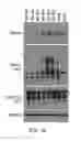 Fig. 02 - METHOD FOR DETERMINING DISEASE SEVERITY IN TAUOPATHY-RELATED NEURODEGENERATIVE DISORDERS