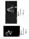 Fig. 06 - METHOD FOR DETERMINING DISEASE SEVERITY IN TAUOPATHY-RELATED NEURODEGENERATIVE DISORDERS
