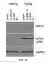 Fig. 07 - METHOD FOR DETERMINING DISEASE SEVERITY IN TAUOPATHY-RELATED NEURODEGENERATIVE DISORDERS