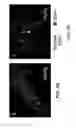 Fig. 08 - METHOD FOR DETERMINING DISEASE SEVERITY IN TAUOPATHY-RELATED NEURODEGENERATIVE DISORDERS
