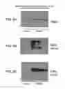 Fig. 16 - METHOD FOR DETERMINING DISEASE SEVERITY IN TAUOPATHY-RELATED NEURODEGENERATIVE DISORDERS