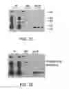 Fig. 18 - METHOD FOR DETERMINING DISEASE SEVERITY IN TAUOPATHY-RELATED NEURODEGENERATIVE DISORDERS