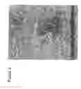 Fig. 17 - BAG3 as biochemical serum and tissue marker