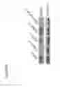 Fig. 22 - BAG3 as biochemical serum and tissue marker
