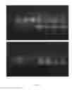 Fig. 08 - EXPRESSION CONSTRUCT FOR YEAST AND A METHOD OF USING THE CONSTRUCT