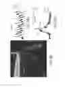 Fig. 07 - Coatings of semiconductor quantum dots for improved visibility of electrodes and pipettes