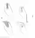 Fig. 06 - Range of motion exerciser