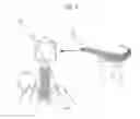 Fig. 06 - Systems and methods for detection of cells using engineered transduction particles