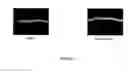Fig. 04 - Substituted pyrido[2,3-d]pyrimidines for dry skin and anti-ageing application