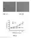 Fig. 02 - Methods for Inhibiting or Reversing Epiretinal Membrane Formation
