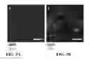 Fig. 03 - Methods for Inhibiting or Reversing Epiretinal Membrane Formation