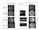 Fig. 09 - Methods for Inhibiting or Reversing Epiretinal Membrane Formation