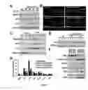 Fig. 04 - COMPOSITIONS AND METHODS FOR DIAGNOSIS AND THERAPY OF DISORDERS RELATED TO ALTERATIONS OF MYH9