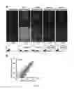 Fig. 07 - COMPOSITIONS AND METHODS FOR DIAGNOSIS AND THERAPY OF DISORDERS RELATED TO ALTERATIONS OF MYH9
