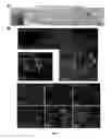 Fig. 08 - COMPOSITIONS AND METHODS FOR DIAGNOSIS AND THERAPY OF DISORDERS RELATED TO ALTERATIONS OF MYH9