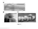 Fig. 11 - COMPOSITIONS AND METHODS FOR DIAGNOSIS AND THERAPY OF DISORDERS RELATED TO ALTERATIONS OF MYH9