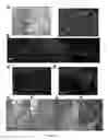 Fig. 13 - COMPOSITIONS AND METHODS FOR DIAGNOSIS AND THERAPY OF DISORDERS RELATED TO ALTERATIONS OF MYH9