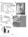 Fig. 18 - COMPOSITIONS AND METHODS FOR DIAGNOSIS AND THERAPY OF DISORDERS RELATED TO ALTERATIONS OF MYH9