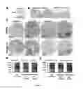 Fig. 23 - COMPOSITIONS AND METHODS FOR DIAGNOSIS AND THERAPY OF DISORDERS RELATED TO ALTERATIONS OF MYH9