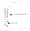 Fig. 11 - NOVEL REAGENTS AND METHOD FOR CONJUGATING BIOLOGICAL MOLECULES