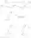 Fig. 12 - 23-yne-vitamin Dderivative