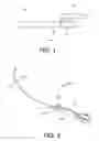 Fig. 02 - INCONTINENCE IMPLANT, INSERTION DEVICE AND RELATED METHODS OF USE