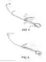 Fig. 04 - INCONTINENCE IMPLANT, INSERTION DEVICE AND RELATED METHODS OF USE