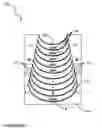Fig. 06 - Medical scope attachment device and system