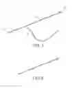 Fig. 02 - Method of Placing a Drainage Catheter System