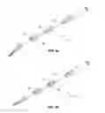 Fig. 03 - Surgical instrument