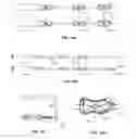 Fig. 07 - Surgical instrument