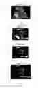 Fig. 05 - Ultrasonographic images processing