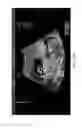 Fig. 19 - Ultrasonographic images processing